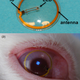 Illustration for article titled Engineers have created an LED display you can wear like a contact lens